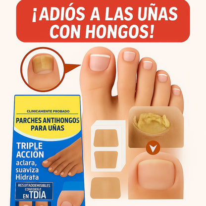 Kit Corrector de Uñas "Perfect Step"✨ | Alivio y Belleza para tus Pies